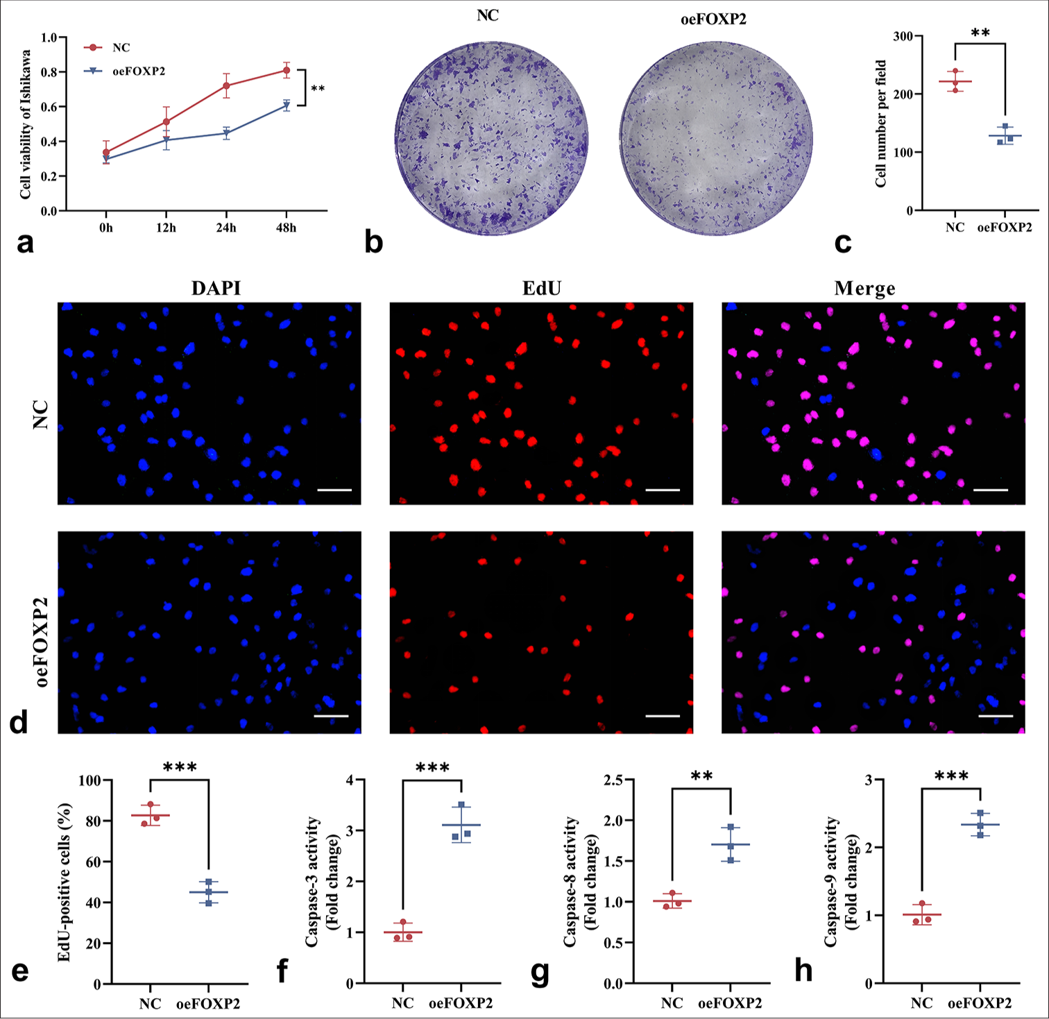 Impact of FOXP2 overexpression on the viability and proliferation of EC cells. (a) CCK-8 assay showing reduced cell viability in the oeFOXP2 Group. (b and c) Colony formation assay revealing a decrease in colony number in the oeFOXP2 Group. (d and e) EdU assay showing a reduction in the proportion of EdU-positive cells in the oeFOXP2 Group. (f-h) ELISA kits were used to evaluate the activities of caspase-3, caspase-8, and caspase-9. Scale bars: 25 μm (×400 magnification). The experiments were carried out in sets of three, with the outcomes reported as the mean (n = 3). ✶✶P < 0.01, ✶✶✶P < 0.001. EC: Endometrial cancer, CCK-8: Cell counting kit-8, FOXP2: Forkhead box protein P2, NC: Negative control, oeFOXP2: Overexpression FOXP2, EdU: 5-Ethynyl-2’-deoxyuridine, DAPI: 4’,6-Diamidino-2’-phenylindole, caspase: Cysteinyl aspartate specific proteinase, ELISA: Enzyme-linked immunosorbent assay.