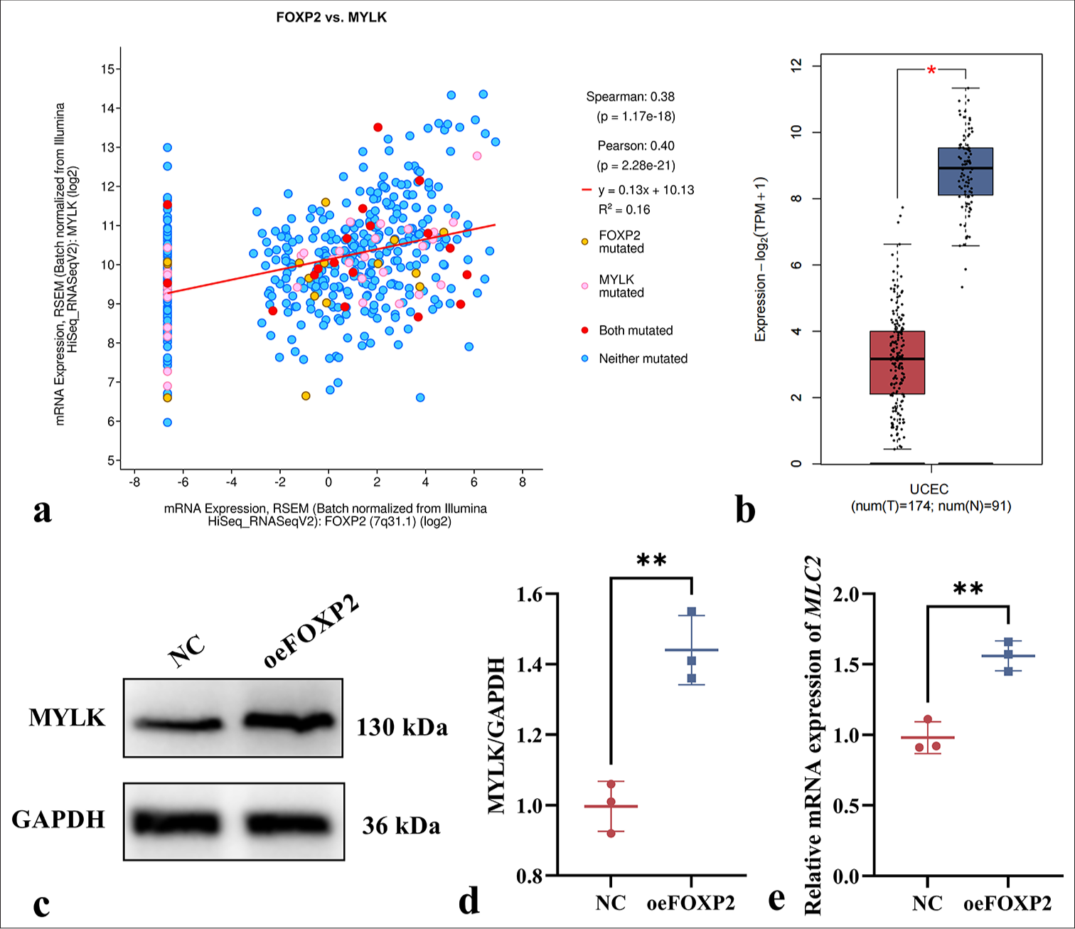FOXP2 regulates MYLK expression in EC cells. (a) Bioinformatics analysis revealing a significant positive correlation between FOXP2 and MYLK expression (cBioPortal). (b) MYLK expression is significantly decreased in EC tissues compared to normal tissues (GEPIA2 Database). (c-e) The expression levels of MYLK. The experiments were carried out in sets of three, with the outcomes reported as the mean (n = 3). ✶P < 0.05, ✶✶P < 0.01. EC: Endometrial cancer, FOXP2: Forkhead box protein P2, MYLK: Myosin light chain kinase, NC: Negative control, oeFOXP2: overexpression FOXP2, GAPDH: Glyceraldehyde-3-phosphate dehydrogenase.