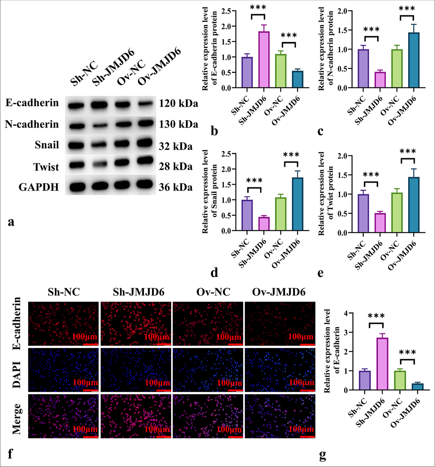 JMJD6 Promotes EMT in GC Cells. (a-e) Western blot analysis of the EMT-related proteins E-cadherin, N-cadherin, Snail, and Twist following JMJD6 knockdown or overexpression. (f and g) Immunofluorescence analysis of E-cadherin expression in MKN-45 cells with different levels of JMJD6 expression. n = 6. ✶✶✶P < 0.001. JMJD6: Jumonji domain–containing protein 6, Sh-NC: ShRNA-negative control, Sh-JMJD6: ShRNA-JMJD6, Ov-NC: Overexpression-negative control, Ov-JMJD6: Overexpression-JMJD6, E-cadherin: Epithelial cadherin, N-cadherin: Neural cadherin, Snail: Snail family transcriptional repressor 1, Twist: Twist family BHLH transcription factor 1, GAPDH: glyceraldehyde-3-phosphate dehydrogenase, DAPI: 4',6-diamidino-2-phenylindole, GC: Gastric cancer, EMT: Epithelial–mesenchymal transition, MKN-45: Gastric cancer cell line.