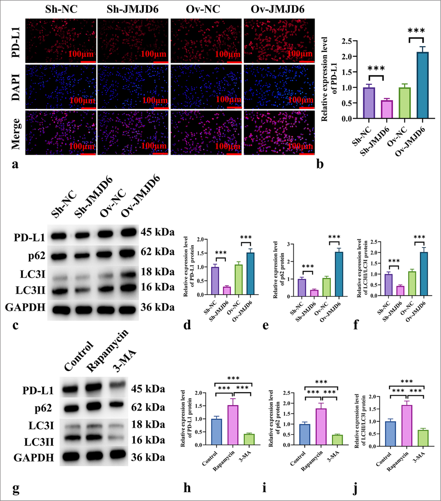 JMJD6 increases PD-L1 expression in GC cells by activating autophagy. (a and b) Immunofluorescence analysis of PD-L1 expression in MKN-45 cells with different levels of JMJD6 expression. (c-f) Western blot analysis of PD-L1 and the autophagy-related proteins LC3II, LC3I, and p62. (g-j) Western blot analysis of PD-L1 and the autophagy-related proteins LC3II, LC3I, and p62 in MKN-45 cells treated with starvation, rapamycin, and 3-MA for 24 h. n = 6. ✶✶✶P < 0.001. JMJD6: Jumonji domain–containing protein 6, PD-L1: Programmed death-ligand 1, Sh-NC: ShRNA-negative control, Sh-JMJD6: ShRNA-JMJD6, Ov-NC: Overexpression-negative control, Ov-JMJD6: Overexpression-JMJD6, p62: Sequestosome 1, LC3: Microtubule-associated protein 1A/1B-light chain 3, 3-MA: 3-methyladenine, GC: Gastric cancer, MKN-45: Gastric cancer cell line, GAPDH: glyceraldehyde-3-phosphate dehydrogenase