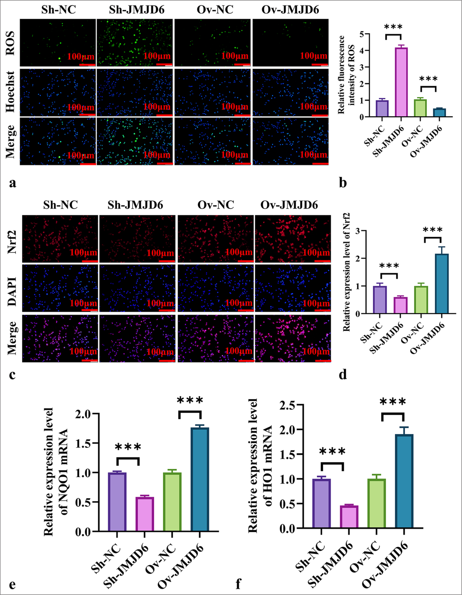 JMJD6 activates the Nrf2 signaling pathway during autophagy in GC cells. (a and b) Immunofluorescence measurement of ROS levels in MKN-45 cells. (cand d) Immunofluorescence measurement of Nrf2 expression in MKN-45 cells. (e and f) qRT-PCR analysis of NQO1 and HO1 mRNA expression levels. n = 6. ✶✶✶P < 0.001. JMJD6: Jumonji domain–containing protein 6, Sh-NC: ShRNA-negative control, Sh-JMJD6: ShRNA-JMJD6, Ov-NC: Overexpression-negative control, Ov-JMJD6: Overexpression-JMJD6, ROS: Reactive oxygen species, DAPI: 4',6-diamidino-2-phenylindole, Nrf2: Nuclear factor erythroid 2–related factor 2, NQO1: NAD(p)H: quinone oxidoreductase 1, HO1: heme oxygenase-1, qRT-PCR: Quantitative reverse transcription polymerase chain reaction, GC: Gastric cancer, MKN-45: Gastric cancer cell line.