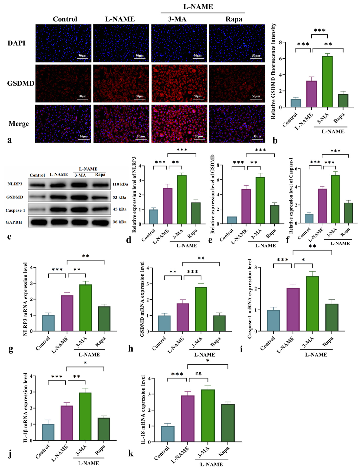 Effect of mitophagy on the modulation of NLRP3-driven pyroptosis and inflammation-associated markers. (a) Immunofluorescent detection of GSDMD expression in HUVECs from different experimental groups (at ×200 magnification, scale bar: 50 µm). (b) GSDMD immunofluorescence quantification graph. (c) WB for the detection of NLRP3, GSDMD, and caspase-1 protein levels. (d-f) Quantitative analysis of the content of pyroptosis-related proteins NLRP3, GSDMD, and caspase-1. (g-k) qRT-PCR for the measurement of NLRP3, GSDMD, caspase-1, IL-1β, and IL-18 messenger RNA expression levels. n = 3, Data are shown as the means ± SD. (✶P < 0.05, ✶✶P < 0.01, ✶✶✶P < 0.001, vs. L-NAME, NS indicates no significance). HUVECs: Human umbilical vein endothelial cells, L-NAME: Nω-Nitro-L-arginine methyl ester, 3-MA: 3-Methyladenine, Rapa: Rapamycin, NLRP3: Nucleotide-binding oligomerization domain-like receptor protein 3, GSDMD: Gasdermin-D, IL-1β: Interleukin-1β, DAPI: 4',6-diamidino-2-phenylindole, Caspase-1: Cysteine-aspartic acid protease-1, IL-18: Interleukin-18, WB: Western blot, qRT-PCR: Quantitative real-time polymerase chain reaction, SD: Standard deviation.
