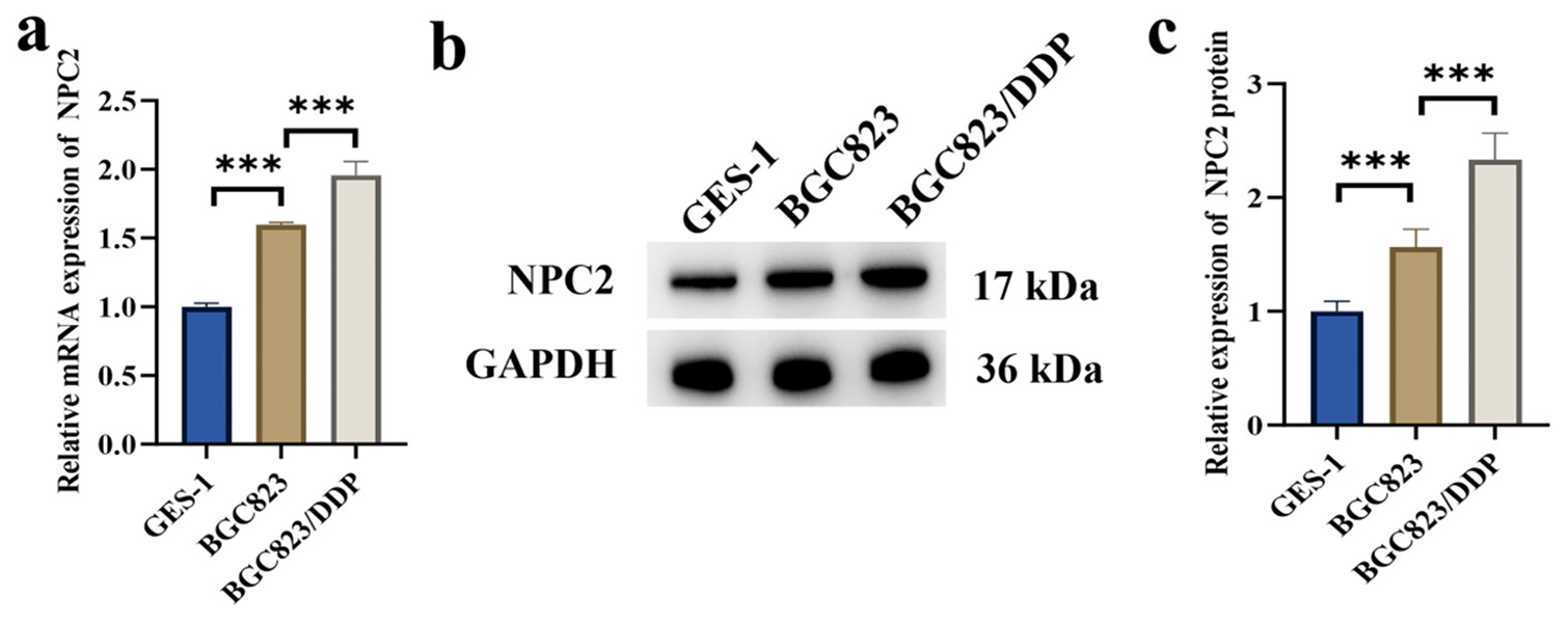 Expression of NPC2 in GC cells. (a) mRNA levels of NPC2 in GES-1 and GC cells. (b and c) Protein levels of NPC2 in GES-1 and GC cells. (n=3). (✶✶✶P < 0.001). NPC2: NPC intracellular cholesterol transporter 2, GAPDH: Glyceraldehyde-3-phosphate dehydrogenase, GES-1: Gastric epithelial cells, GC: Gastric cancer; mRNA, messenger Ribonucleic Acid.