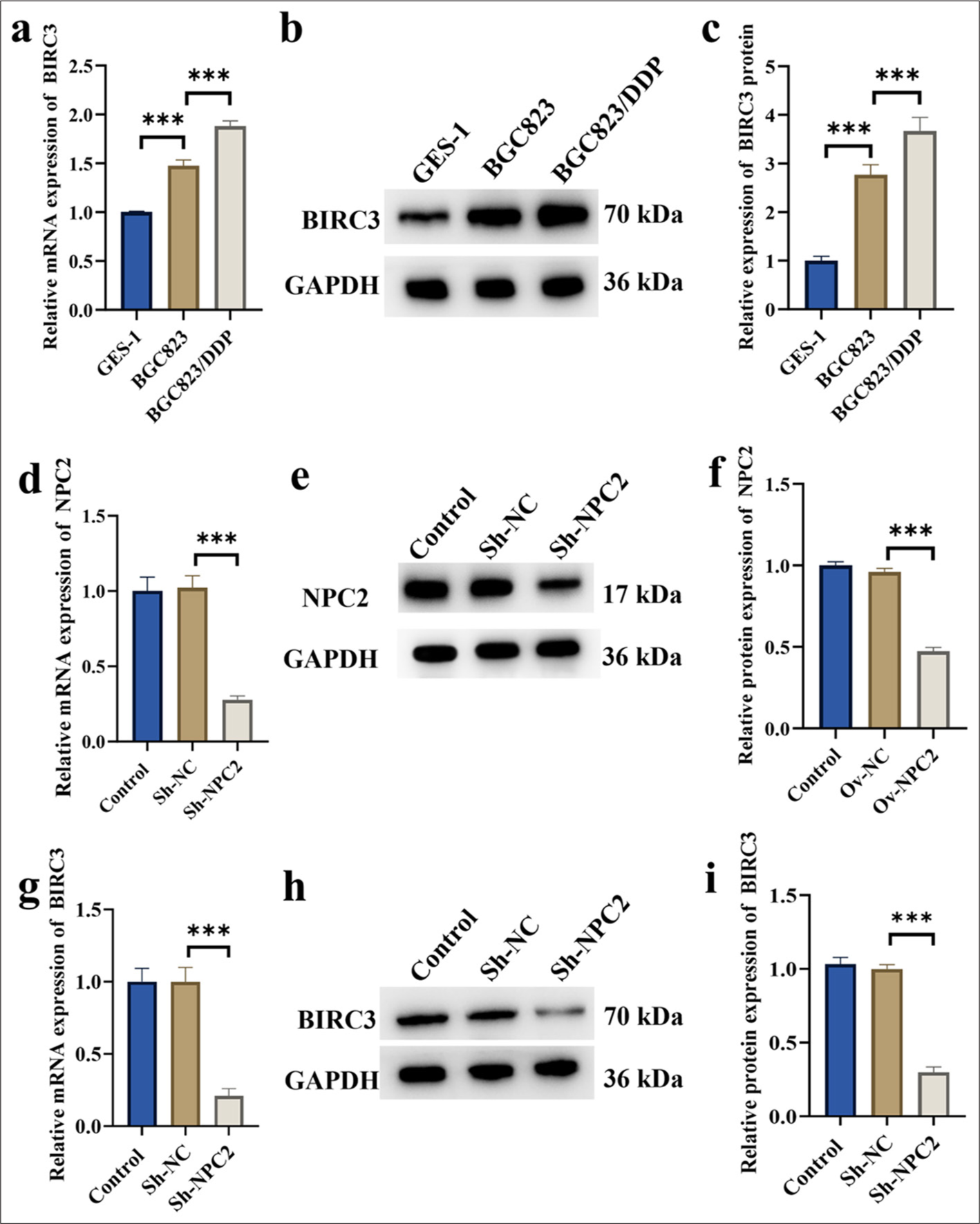 NPC2-regulated BIRC3 genes in DDP-resistant cells. (a) BIRC3 mRNA expression in DDP-resistant cells. (b-c) BIRC3 protein expression in DDP-resistant cells. (d) The efficiency of NPC2 knockdown was verified by qRT-PCR. (e-f) The efficiency of NPC2 knockdown was verified by Western blotting. (g) Impact of NPC2 knockdown on BIRC3 mRNA expression in BGC823/DDP cells. (h-i) Impact of NPC2 knockdown on BIRC3 protein expression in BGC823/DDP cells. (n = 3). (✶✶✶P < 0.001). NPC2: NPC intracellular cholesterol transporter 2, BIRC3: Baculoviral inhibitor of apoptosis repeat containing 3, Sh-NC: ShRNA negative control, Sh-NPC2: ShRNA NPC intracellular cholesterol transporter 2, qRT-PCR: Quantitative real-time polymerase chain reaction, DDP: Cisplatin.