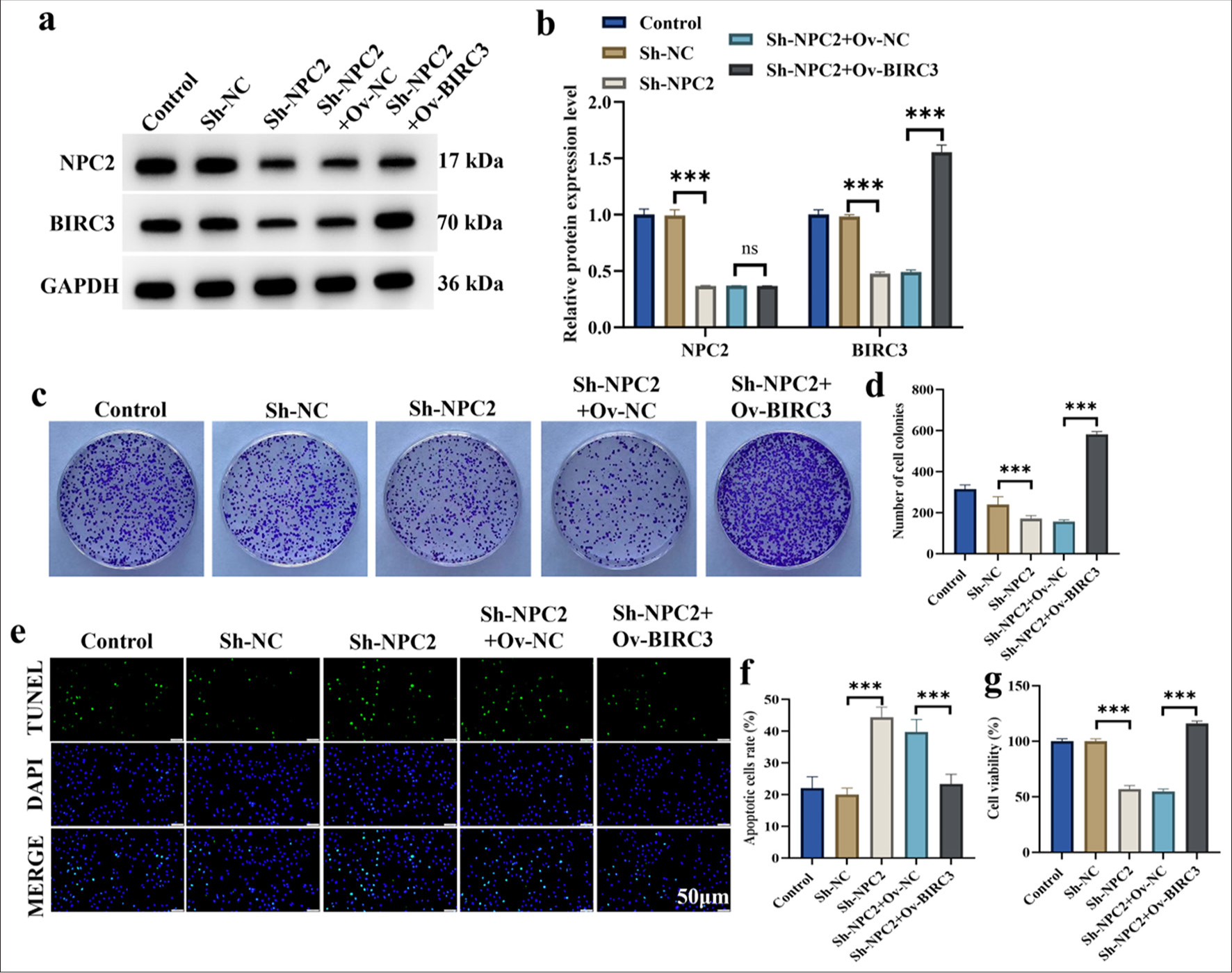 BIRC3 overexpression restored the cell viability reduced by NPC2 knockdown in BGC823/DDP cells. (a and b) The efficiency of NPC2 knockdown and BIRC3 overexpression was verified by Western blotting. (c) Pictures of cell colonies. (d) Statistical analysis of cell-colony formation assay. (e) Pictures of TUNEL assay. (f) Statistical analysis of TUNEL assay. (g) Cell viability. (n = 3). (ns: No significant difference; ✶✶✶P < 0.001). NPC2: NPC intracellular cholesterol transporter 2, BIRC3: Baculoviral inhibitor of apoptosis repeat containing 3, DDP: Cisplatin, TUNEL: Terminal deoxynucleotidyl transferase-mediated dUTP nick end labeling.