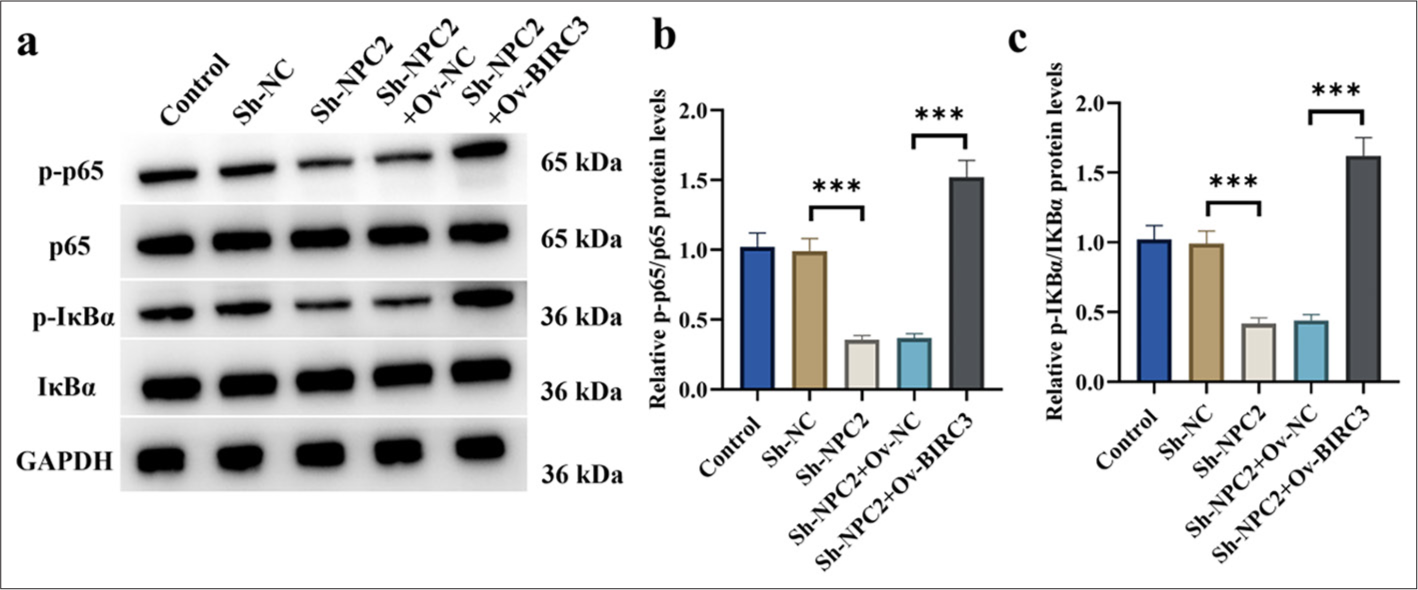 NPC2 and BIRC3 were involved in activating the NF-κB signaling pathway in BGC823/DDP cells. (a-c) The protein levels of p65, p-p65, IκBα, and p-IκBα in BGC823/DDP cells were determined by Western blotting. (n = 3) (✶✶✶P < 0.001). p65: Phosphoprotein 65, p-p65: Phosphorylated p65, IκBα: Inhibitor of nuclear factor kappa B alpha, p-IκBα: Phosphorylated IκBα, NF-κB: Nuclear factor kappa-B, NPC2: NPC intracellular cholesterol transporter 2, BIRC3: Baculoviral inhibitor of apoptosis repeat containing 3, DDP: Cisplatin.