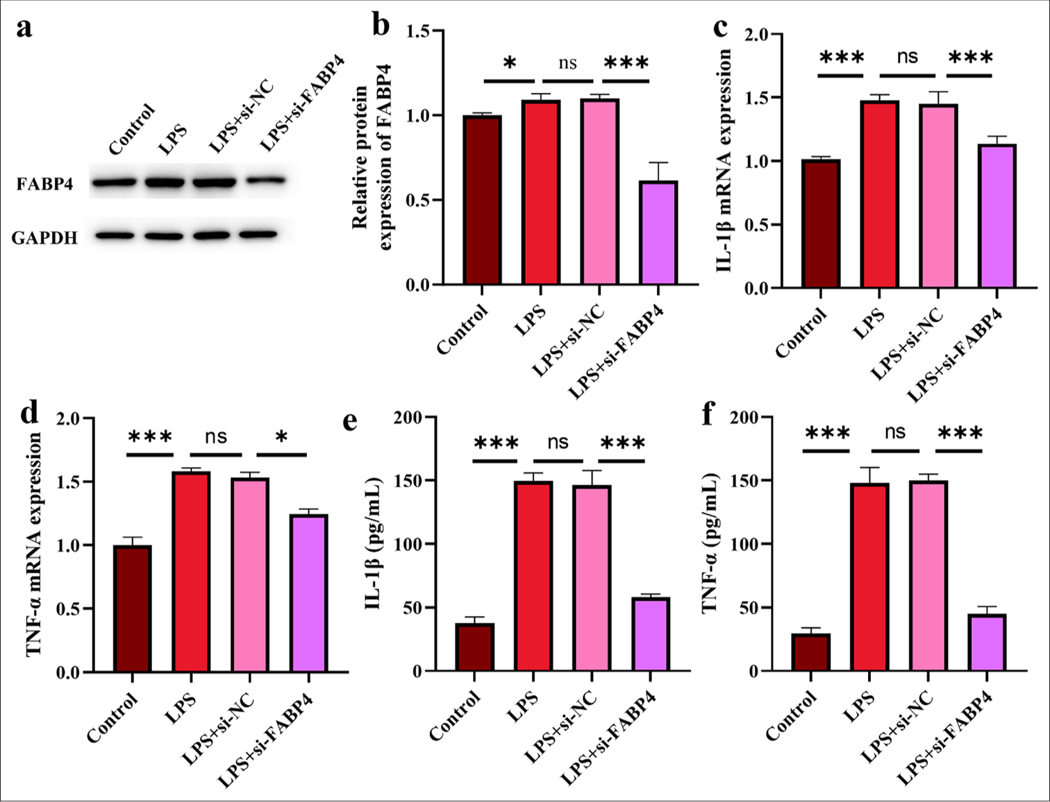 Silencing FABP4 inhibits H9c2 cell inflammatory cytokines. (a and b) Silence FABP4 validation assay by Western blot. (c and d) IL-1β and TNF-α mRNA expressions. (e and f) IL-1β and TNF-α expressions. n = 3, ns: No statistical significance, ✶P < 0.05, ✶✶✶P < 0.001. FABP4: Fatty acid-binding protein 4, TNF-α: Tumor necrosis factor-α, IL: Interleukin, mRNA: Messenger RibonucleicAcid.