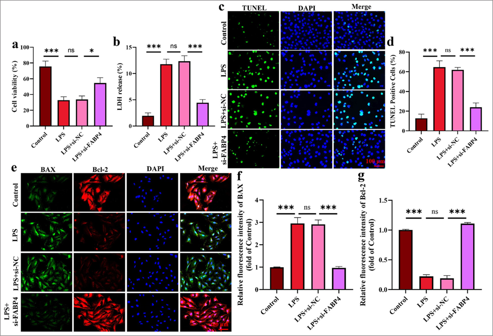 Silencing FABP4 inhibited H9c2 cell apoptosis. (a) CCK-8 assay. (b) LDH ELISA assay. (c and d) TUNEL staining. (e-g) Immunofluorescence staining of BAX and Bal-2. n = 3, ns: No statistical significance, ✶P < 0.05, ✶✶✶P < 0.001. LDH: Layered double hydroxides, TUNEL: Terminal deoxynucleotidyl transferase-mediated dUTP nick end labeling, DAPI: 4’,6-diamidino-2-phenylindole, BAX: Bcl-2-associated X protein, Bcl-2: B-cell lymphoma-2, FABP4: Fatty acid-binding protein 4, CCK-8: Cell counting kit-8, ELISA: Enzyme-linked immunosorbent assay.