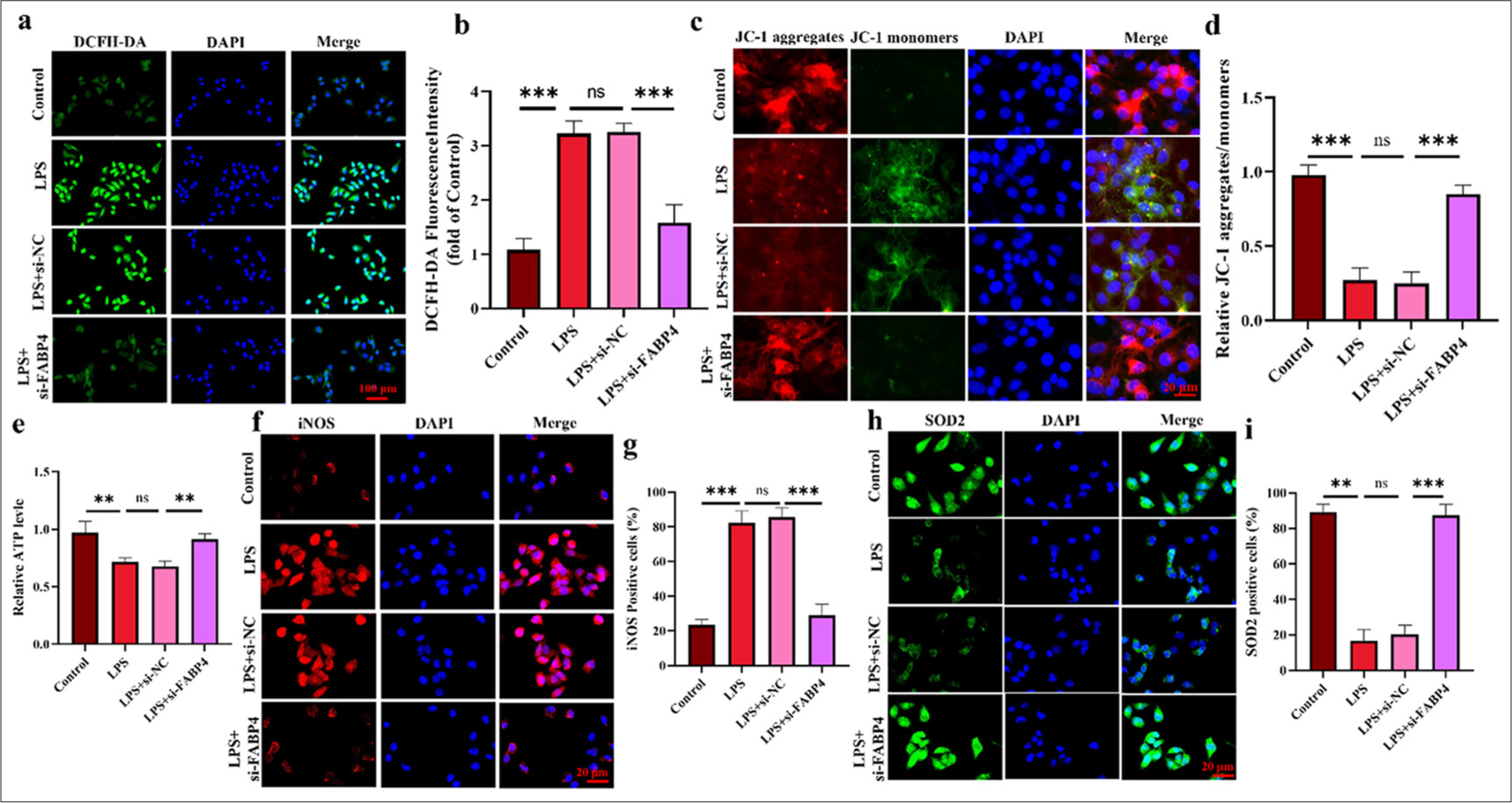 Silencing FABP4 increased the antioxidant activity of H9c2 cells. (a and b) ROS levels were analyzed using DCFH-DA staining. (c and d) JC-1 staining assay. (e) ATP levels of H9c2 cells. (f-i) Immunofluorescence staining and quantification results of iNOS and SOD2. n = 3, ns: No statistical significance, ✶✶P < 0.01, ✶✶✶P < 0.001. DCFH-DA: 2’,7’-Dichlorodihydrofluorescein diacetate, JC-1: 5,5',6,6'-Tetrachloro-1,1',3,3'-tetraethylimidacarbocyanine, iNOS: Inducible nitric oxide synthase, SOD2: Superoxide dismutase 2, FABP4: Fatty acid-binding protein 4, ROS: Reactive oxygen species.