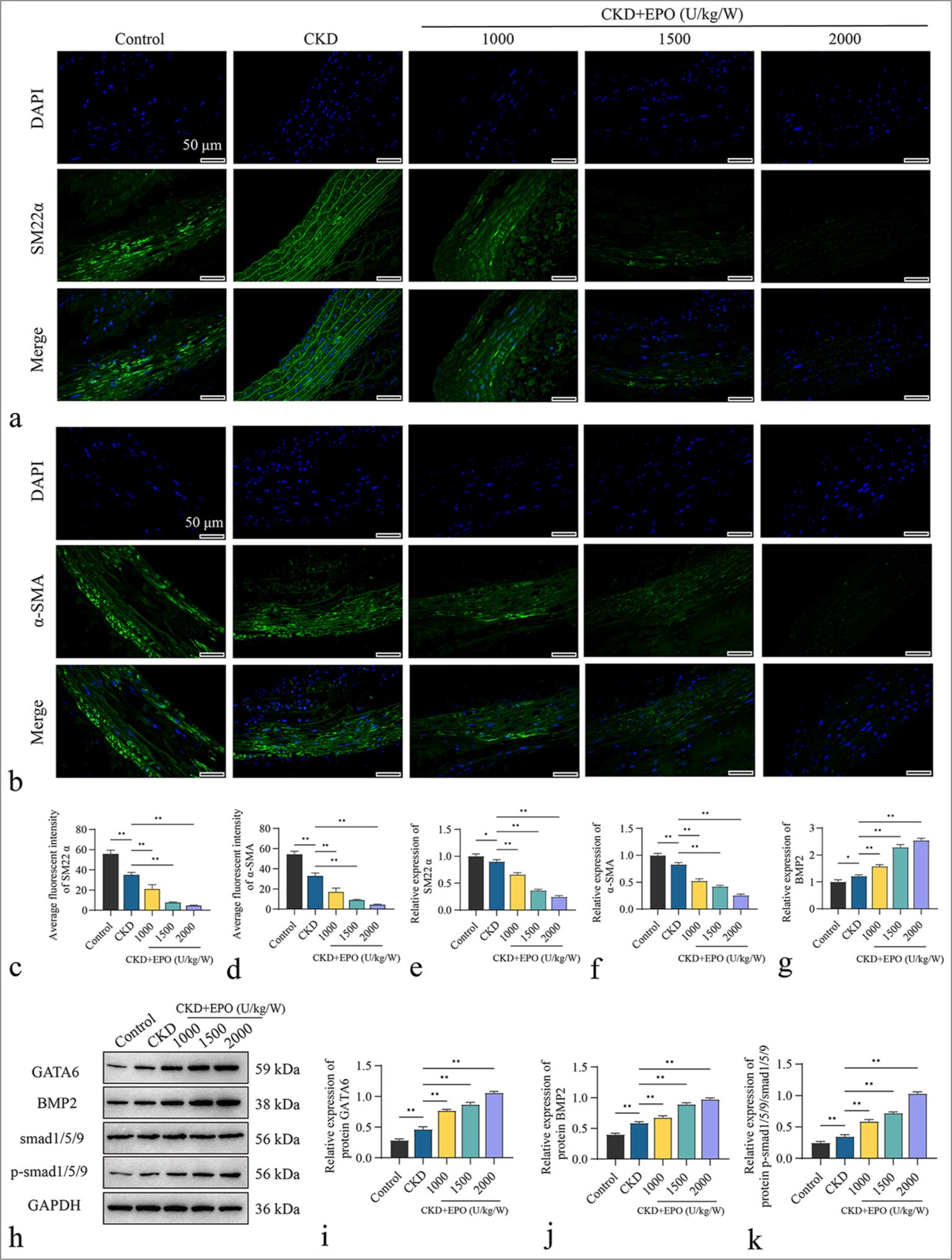 Dose-dependent response of aortic calcification to EPO in CKD rats. (a and b) Immunofluorescence detection of the effect of EPO on the expression levels of SM22a and a-SMA in the abdominal aortic membrane tissue of CKD rats. (c and d) Statistical analysis of the average fluorescence intensity of SM22a and a-SMA. (e-g) RT-qPCR characterization of the effect of EPO on the mRNA levels of SM22a, a-SMA, and BMP2 in the abdominal aortic membrane tissues of CKD rats. (h) WB detection of the effect of EPO on the protein expression levels of GATA6, BMP2, Smad1/5/9, and p-Smad1/5/9 in the abdominal aortic tunica media tissue of CKD rats. (i-k) Gray value statistics for GATA6, BMP2, Smad1/5/9, and p-Smad1/5/9. Scale bar = 50 μm, n = 3. Data are shown as mean ± standard deviation. ✶P < 0.05 and ✶✶P < 0.01. EPO: Erythropoietin, CKD: Chronic kidney disease, a-SMA: a-Smooth muscle actin, SM22a: Smooth muscle protein 22-a, DAPI: 4’,6-Diamidino-2-phenylindole, RT-qPCR: Real-time quantitative PCR, BMP2: Bone morphogenetic protein 2, GATA6: GATA-binding protein 6, WB: Western blot, GAPDH: Glyceraldehyde-3-phosphate dehydrogenase.