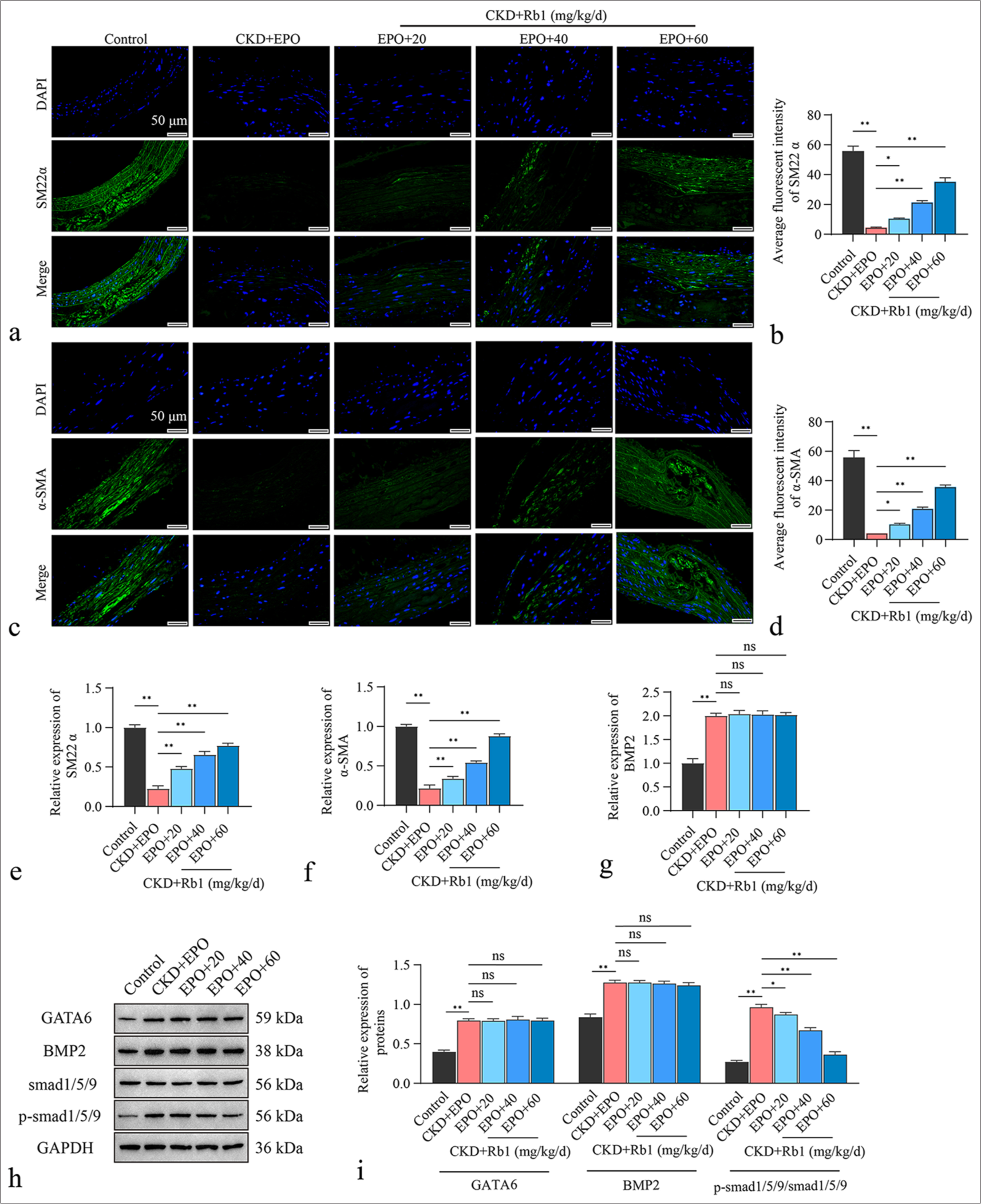 Rb1 blockage of Smad1/5/9 pathway, leading to attenuation of EPO-induced calcification. (a) Immunofluorescence staining of SM22a. (b) Statistical analysis of the average fluorescence intensity of SM22a. (c) Immunofluorescence staining of a-SMA. (d) Statistical analysis of the average fluorescence intensity of a-SMA. (e-g) RT-qPCR detection of the mRNA levels of SM22a, a-SMA, and BMP2 in rat aortic tissues. (h) WB detection of the protein expression levels of GATA6, BMP2, Smad1/5/9, and p-Smad1/5/9 in rat aortic tunica tissues. (i) Gray value statistics for GATA6, BMP2, Smad1/5/9, and p-Smad1/5/9. Scale = 50 μm, n = 3. Data are expressed as mean ± standard deviation. ✶P < 0.05, ✶✶P < 0.01, and ns denotes no statistical significance. Rb1: Ginsenoside Rb1, EPO: Erythropoietin, CKD: Chronic kidney disease, a-SMA: a-Smooth muscle actin, SM22a: Smooth muscle protein 22-a, DAPI: 4’,6-Diamidino-2-phenylindole, BMP2: Bone morphogenetic protein 2, RTqPCR: Real-time quantitative polymerase chain reaction, WB: Western blot GATA6: GATA-binding protein 6, GAPDH: Glyceraldehyde-3-phosphate dehydrogenase.
