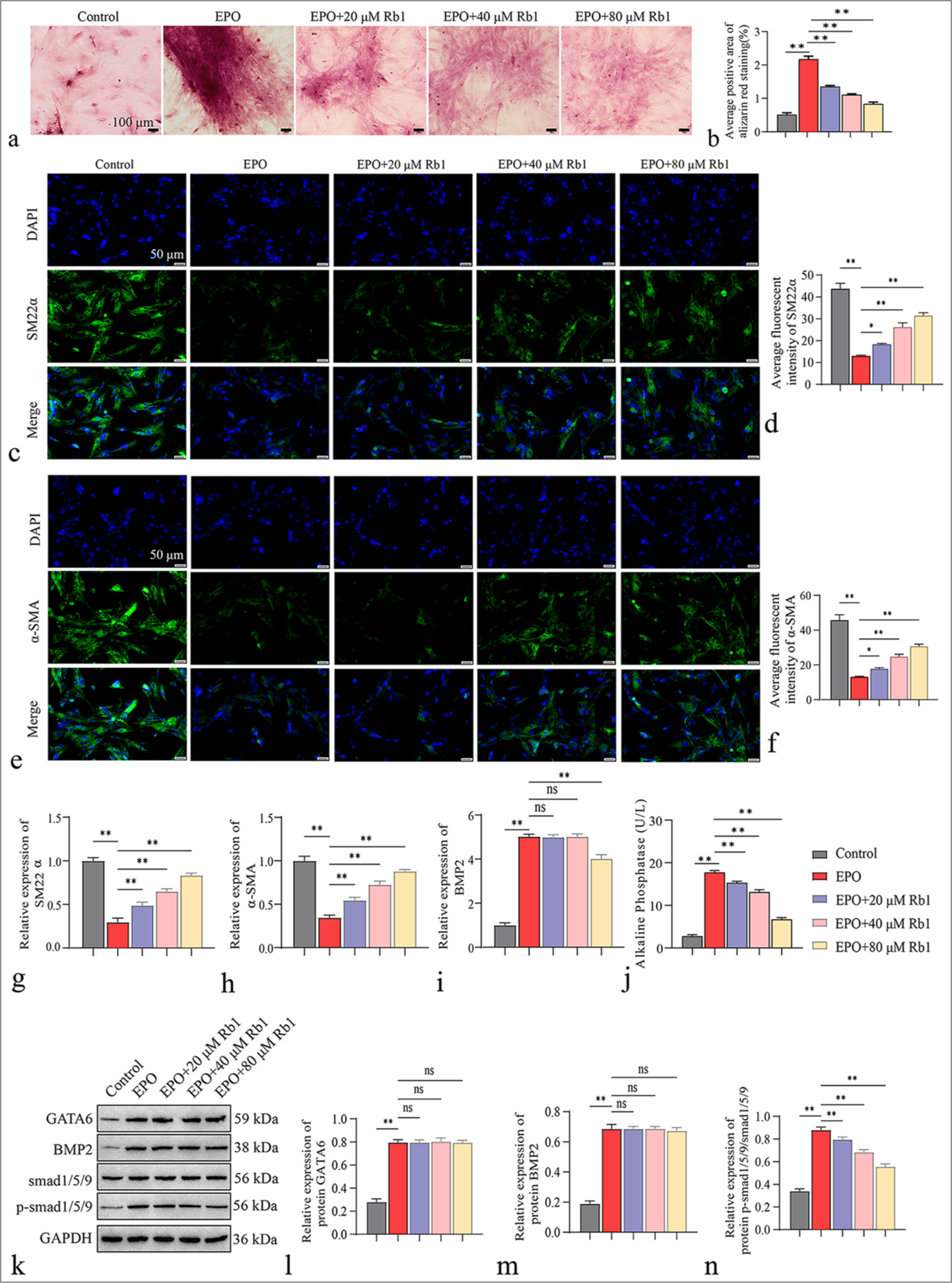 Rb1 reduction in EPO-enhanced VSMC VC in vitro. (a) Alizarin Red staining of calcium deposits in VSMC (scale = 100 μm). (b) Statistical analysis of the average positive area of Alizarin Red staining. (c) Immunofluorescence staining of SM22a in VSMC (scale = 50 μm). d. Statistical analysis of the average fluorescence intensity of SM22a. (e) Immunofluorescence staining of a-SMA in VSMC (scale = 50 μm). (f) Statistical analysis of the average fluorescence intensity of a-SMA. (g-i) RT-qPCR detection of SM22a, a-SMA, and BMP2 mRNA expression levels in VSMC. (j) Detection of ALP activity in VSMC. (k) WB detection of the protein expression levels of GATA6, BMP2, Smad1/5/9 and p-Smad1/5/9 in VSMC. (l-n) Gray value statistics for GATA6, BMP2, Smad1/5/9, and p-Smad1/5/9. n = 3. Data are expressed as mean ± standard deviation. ✶P < 0.05, ✶✶P < 0.01, and ns denotes no statistical significance. Rb1: Ginsenoside Rb1, EPO: Erythropoietin, VC: Vascular calcification, VSMC: Vascular smooth muscle cell, a-SMA: a-Smooth muscle actin, SM22a: Smooth muscle protein 22-a, DAPI: 4’,6-Diamidino-2-phenylindole, BMP2: Bone morphogenetic protein 2, RT-qPCR: Real-time quantitative PCR, ALP: Alkaline phosphatase, WB: Western blot, GATA6: GATA-binding protein 6, GAPDH: Glyceraldehyde-3-phosphate dehydrogenase.