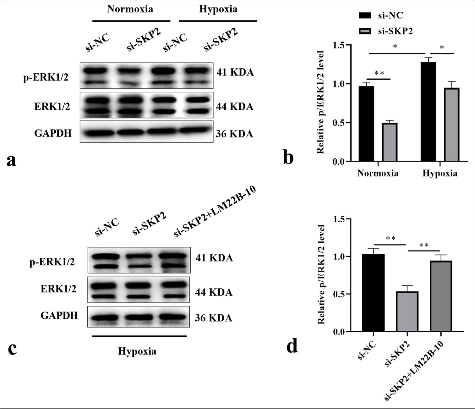 SKP2 knockdown blocked the ERK1/2 pathway in hypoxia-treated SKCM cells. (a and b) p-ERK1/2 and ERK1/2 levels were examined in hypoxia-treated SKCM cells and (c and d) in SKCM cells cotransfected with si-SKP2 and LM22B-10 before hypoxia treatment. ✶P < 0.05; ✶✶P < 0.01. SKCM: Skin cutaneous melanoma, SKP2: S-phase kinase-interacting protein 2, ERK: Extracellular signal-regulated kinase, si-SKP2: Small interfering S-phase kinase-interacting protein 2.