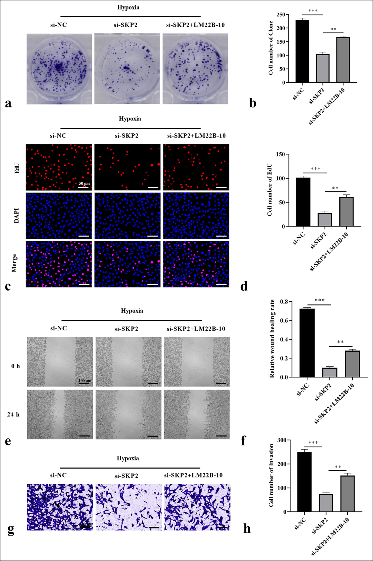 SKP2 knockdown inhibited the hypoxia-induced proliferation, migration, and invasion of SKCM cells through the ERK1/2 pathway. (a and b) Cell formation number, (c and d) EdU-positive cells, (e and f) wound healing rate, and (g and h) cell invasion were measured by colony formation, EdU staining assay (scale = 50 μm), wound healing assay (scale = 100 μm), and Transwell assay (scale = 100 μm), respectively. ✶✶P < 0.01; ✶✶✶P < 0.001. SKCM: Skin cutaneous melanoma, SKP2: S-phase kinase-interacting protein 2, ERK: Extracellular signal-regulated kinase, EdU: 5-Ethynyl-2’-deoxyuridine.