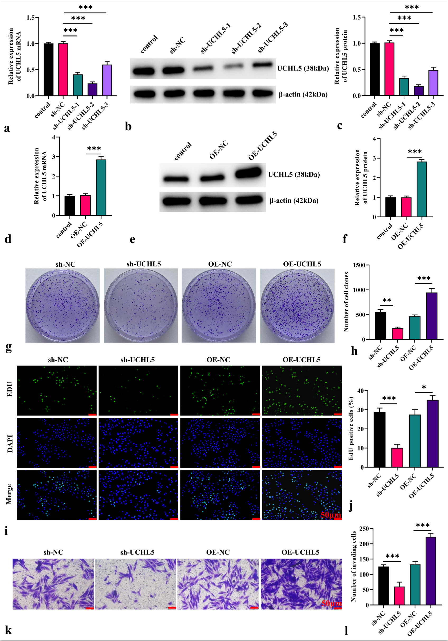 Knockdown of ubiquitin C-terminal hydrolase L5 (UCHL5) inhibited the malignant behavior of renal cell carcinoma cells. (a-f) Quantitative polymerase chain reaction and Western blot analyses confirmed the knockdown or overexpression efficiency of UCHL5. (g and h) Colony formation assays assessed the clonogenic capacity post-transfection. (i and j) Proliferative ability of 786-O cells after transfection was measured by 5-Ethynyl-2'-deoxyuridine assay (scale bar: 50 µm, magnification ×200). (k and l) Transwell assays quantified the invasive potential of 786-O cells (scale bar: 50 µm, magnification ×200). n = 6; ✶P < 0.05, ✶✶P < 0.01, ✶✶✶P < 0.001.
