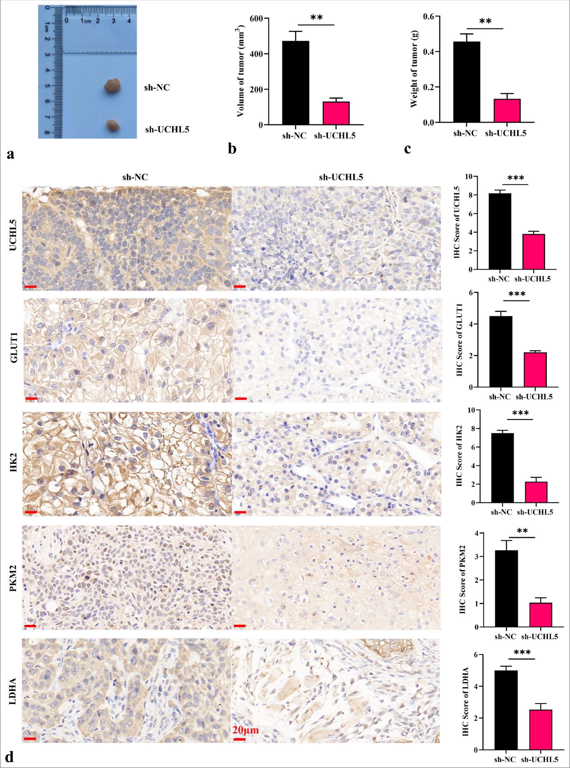 Knockdown of ubiquitin C-terminal hydrolase L5 (UCHL5) reduced the glycolysis level of renal cell carcinoma cells and suppressed tumor development. (a-c) Image, volume, and weight of tumors after treatment with UCHL5 knockdown. (d) Expression of UCHL5 and glycolysis-related proteins detected by immunohistochemistry (scale bar: 20 µm, magnification ×400). n = 6; ✶✶P < 0.01, ✶✶✶P < 0.001.