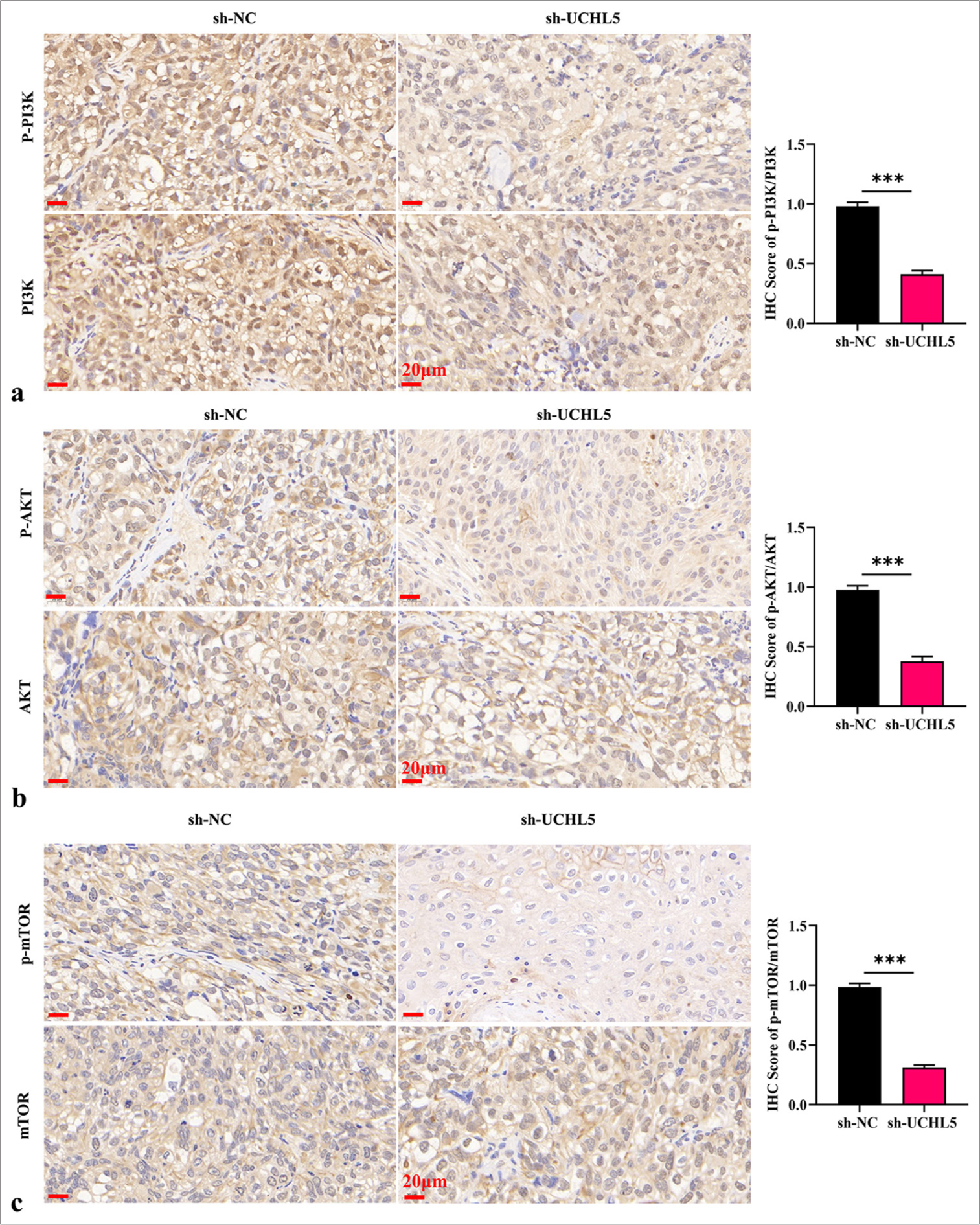Suppressing ubiquitin C-terminal hydrolase L5 (UCHL5) inhibited the activation of the phosphatidylinositol-3-kinase (PI3K)/Protein kinase B (AKT)/Mammalian target of rapamycin (mTOR) pathway in vivo. (a) Immunohistochemistry (IHC) analysis of p-PI3K/PI3K after UCHL5 knockdown in vivo. (b) IHC analysis of phosphorylated AKT/AKT after UCHL5 knockdown in vivo. (c) IHC analysis of p-m-TOR/mTOR after UCHL5 knockdown in vivo. (scale bar: 20 µm, magnification ×400). n = 6; ✶✶✶P < 0.001.