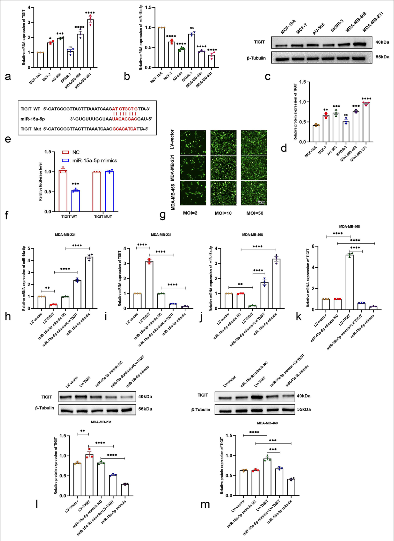 Validation of TIGIT as the target gene of miR-15a-5p and analysis of its expression. (a and b) Quantitative assessment of miR-15a-5p and TIGIT contents between different BC cells and normal breast epithelial cells by utilizing qRT-PCR methodology. (c and d) TIGIT protein abundance in different BC cells was evaluated through WB analysis. (e and f) Direct interaction between miR-15a-5p and TIGIT was validated using the DLR assay. (g) Green fluorescent protein expression patterns in cells transfected with lentiviral constructs at different MOI levels were examined using laser confocal microscopy (Scale bar = 50 μm) (h-k). Effects of transfection with LV-vector, LV-TIGIT, miR-15a-5p mimics, NC, or their combinations in BC cells on the expression profiles were assessed using qRT-PCR (h-k) and WB analyses (l and m). Values are expressed as mean ± SD from three distinct experimental replicates. ns: No significant difference, ✶P <0.05, ✶✶P < 0.01, ✶✶✶P <0.001, and ✶✶✶✶P <0.0001 compared with the NC-transfected cells. qRT-PCR: Quantitative real-time polymerase chain reaction, LV: Lentivirus vector, NC: Negative control, MOI: Multiplicity of infection, WB: Western blotting, SD: Standard deviation, BC: Breast cancer.